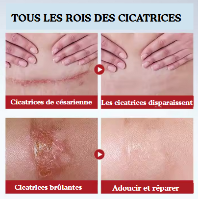 Crème reparatrice de cicatrice